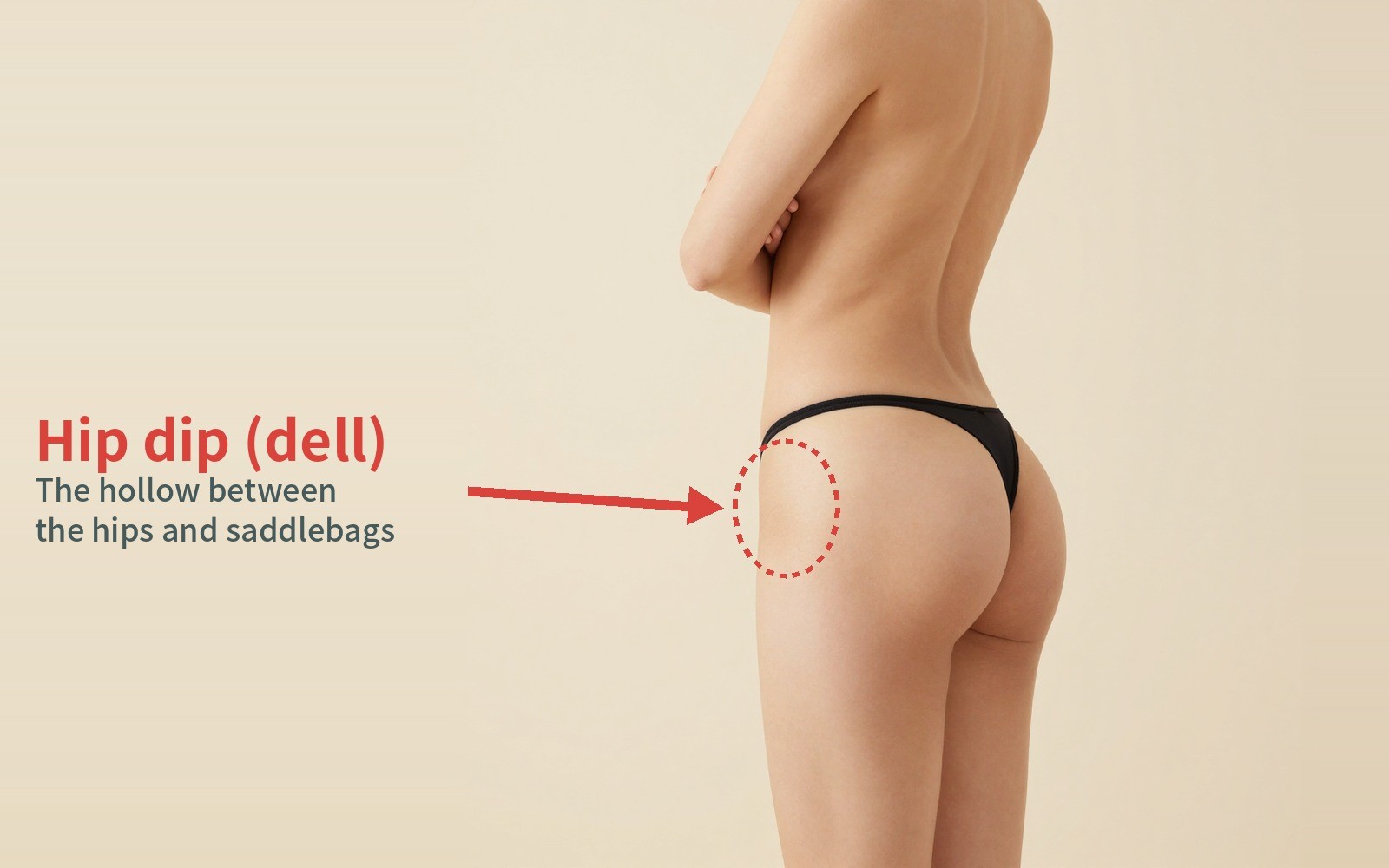 Buttocks seen from a rear oblique angle — arrow marking the indented spot between the hips and saddlebags (hip dip, dell)