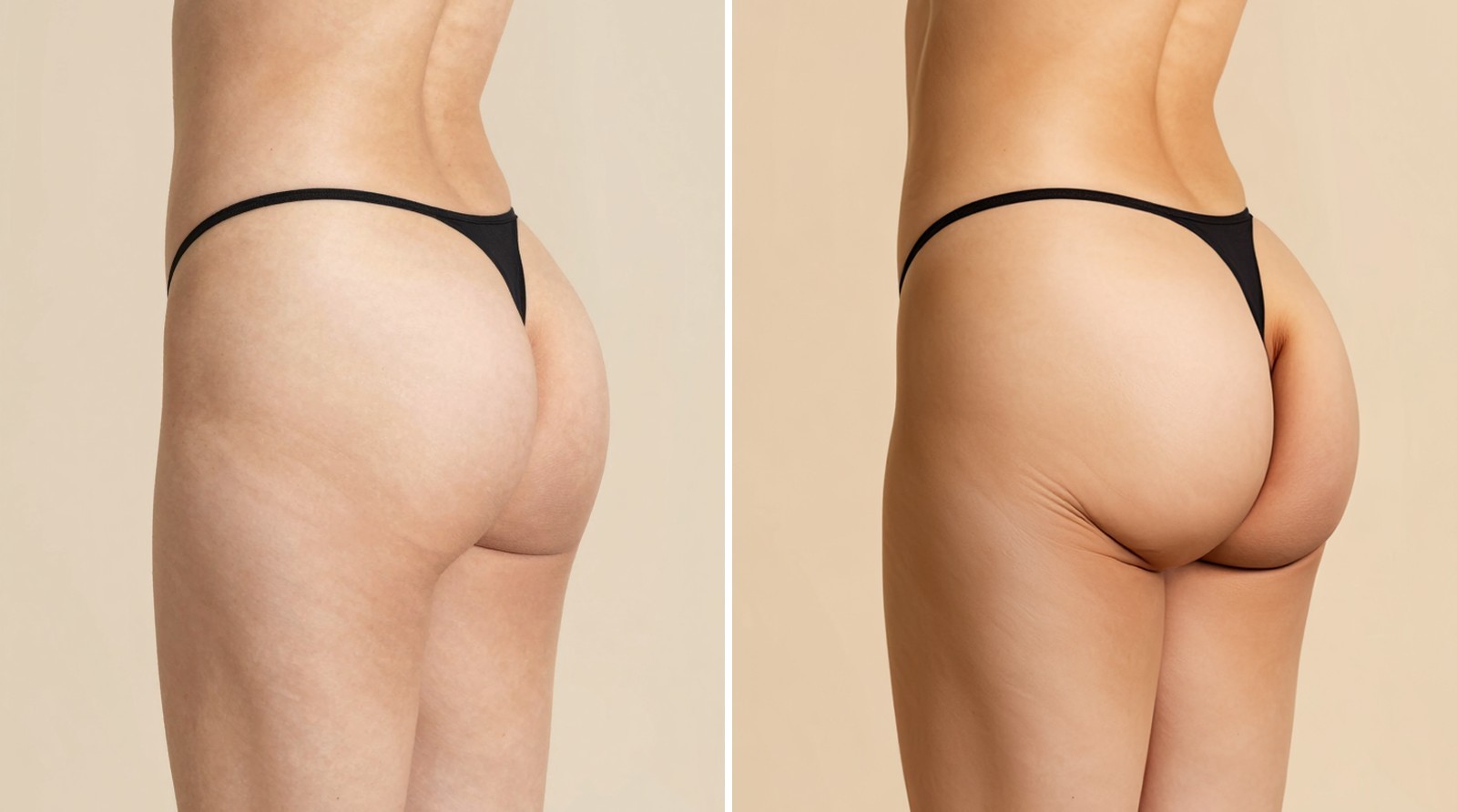 Virtual side-view photos of buttocks by position of the most projecting point