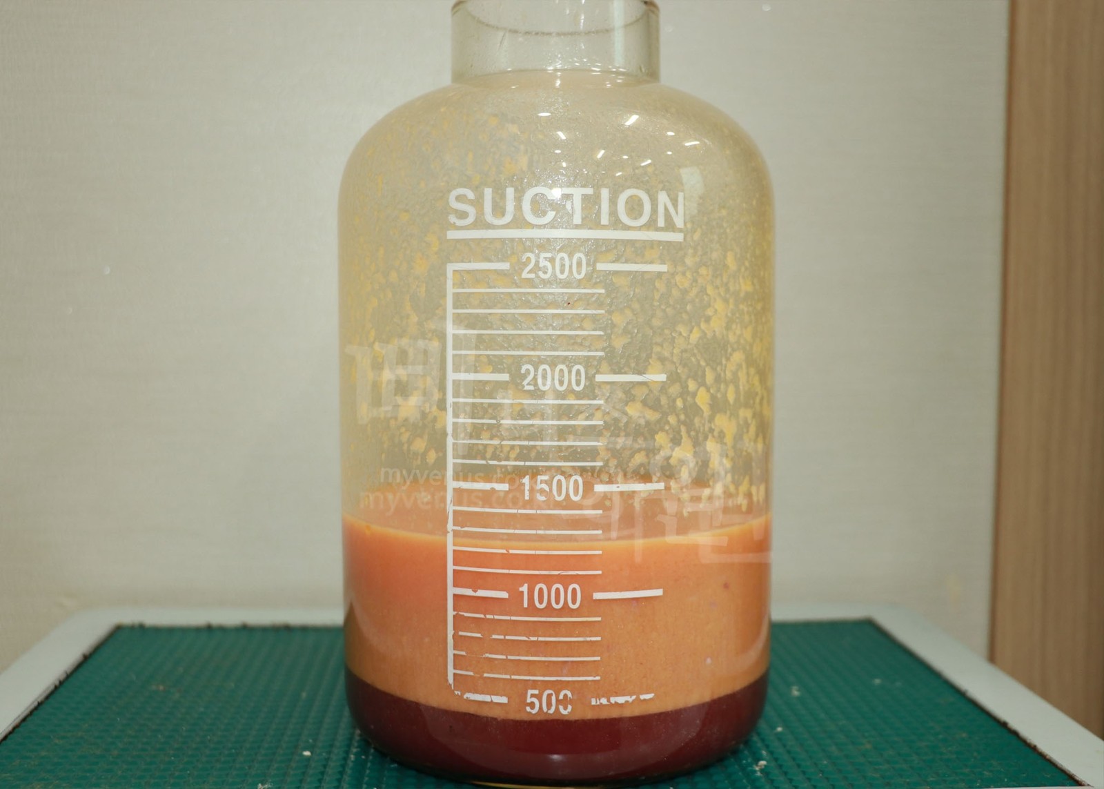 Fat aspirated in liposuction of the buttocks, hips, and sacral back