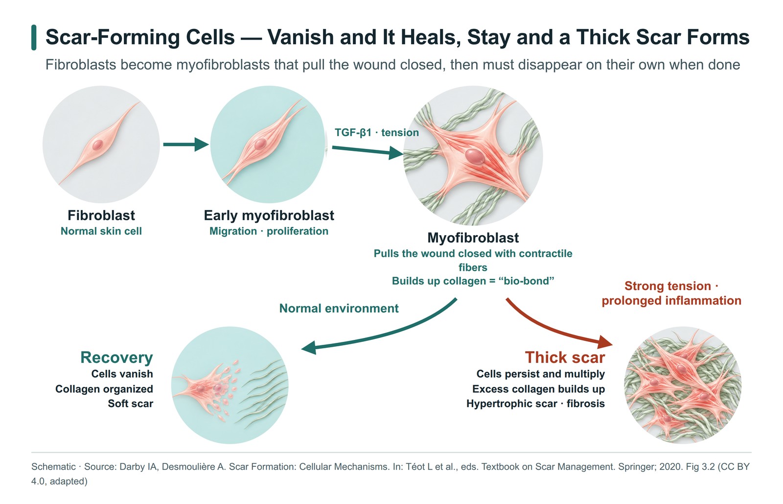 Process in which fibroblasts turn into myofibroblasts; if they disappear the wound recovers, and if they remain a thick scar forms