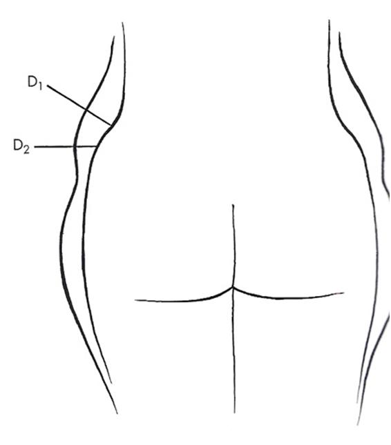 Diagram of the hips and buttocks