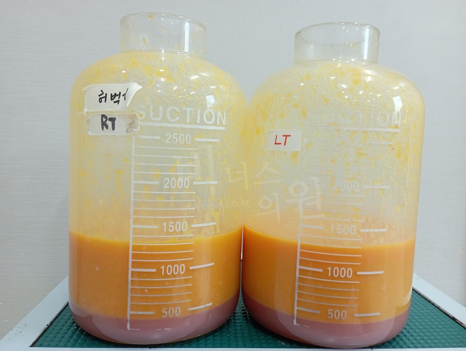 Fat removed by tumescent liposuction: yellow fat in the upper layer and red tumescent fluid in the lower layer