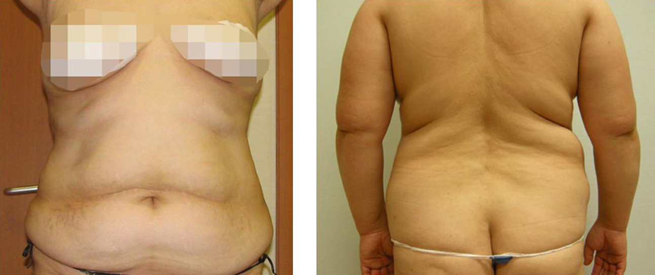 Torso - waist and back areas