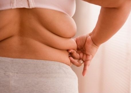 Obesity and liposuction