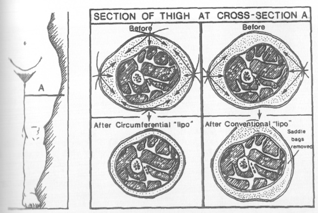 circum.jpg