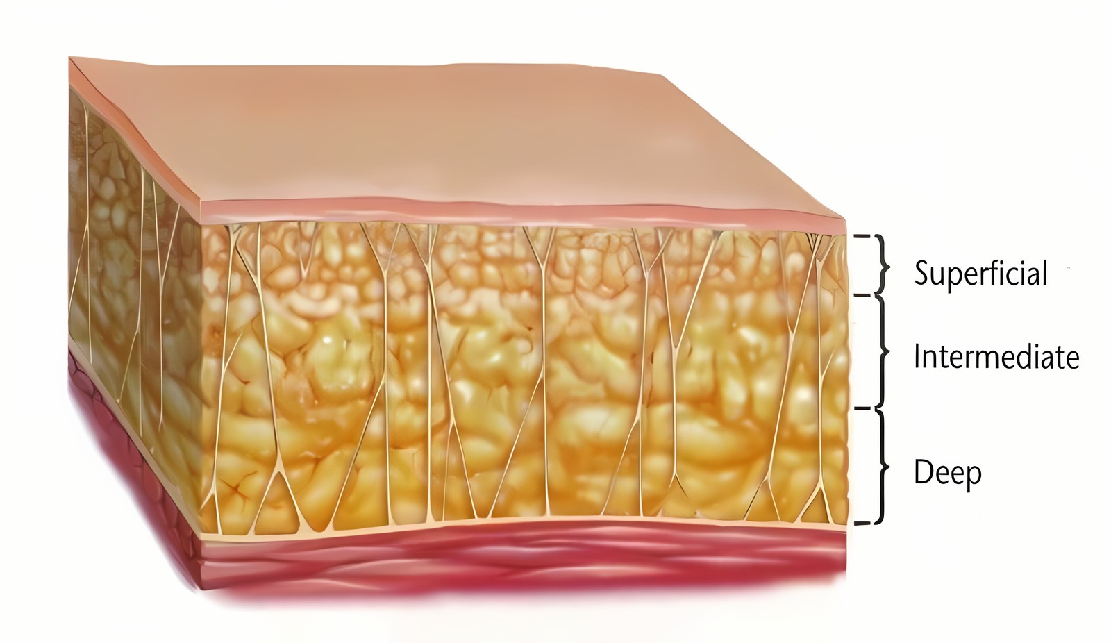 Diagram of the subcutaneous fat layers — the superficial layer just under the skin (Superficial), the intermediate layer (Intermediate), and the deep layer (Deep)