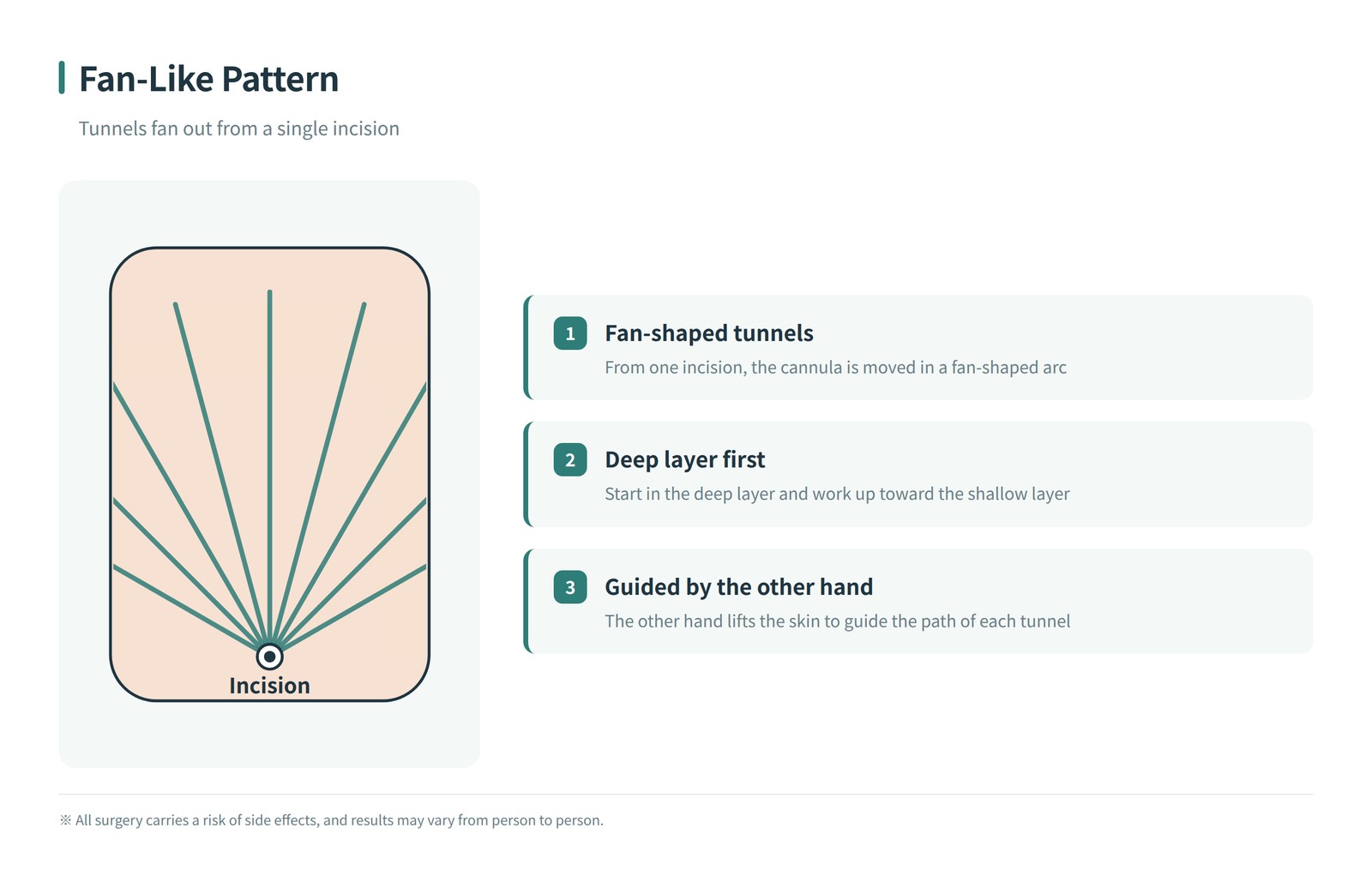 Diagram of the fan-like pattern — tunnels spreading out like a fan from a single incision