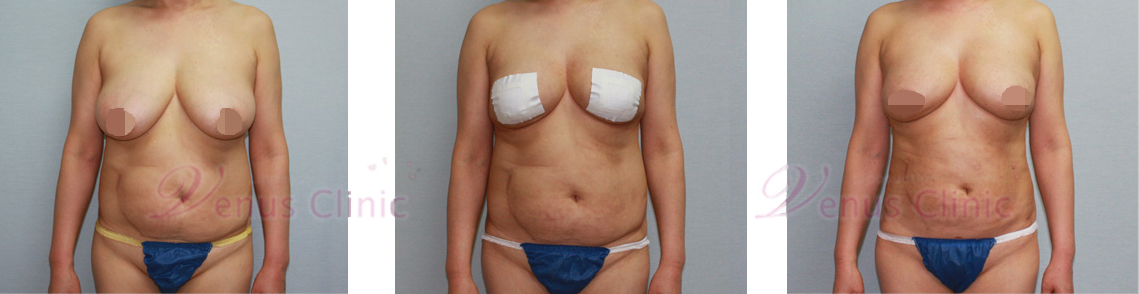 venus-1.jpg