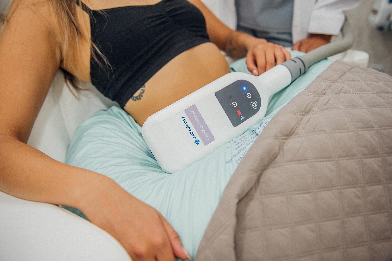 A person receiving cryolipolysis on the abdomen