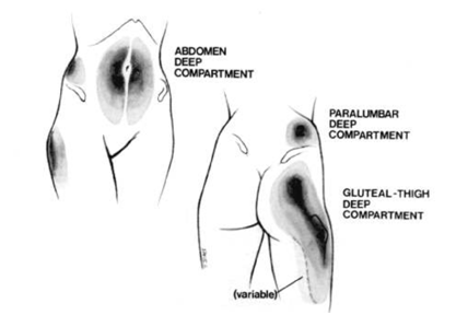 Areas of fat accumulation