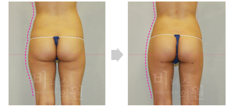 thigh_primimum 1.jpg