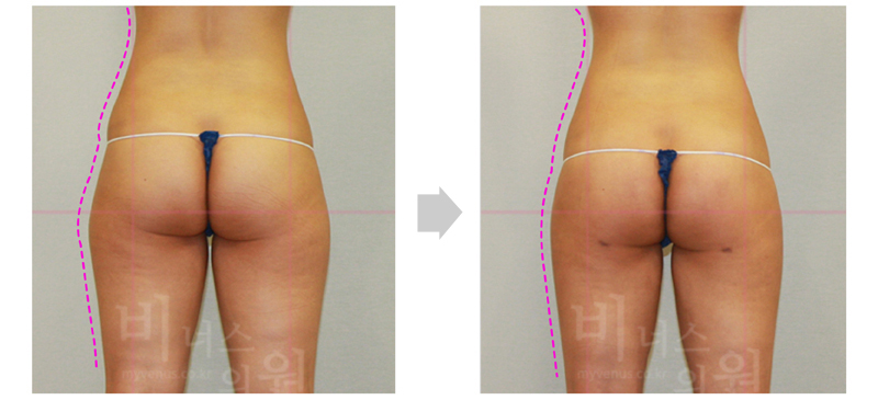 thigh_primimum 2.jpg